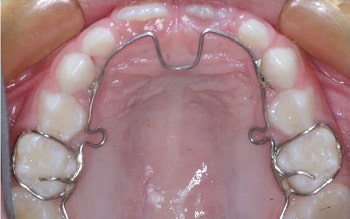 Functional Orthodontics - Radical Wellness